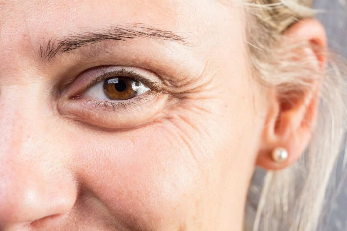 Le zampe di gallina mi facevano apparire vecchia: le ho attenuate così, senza crema