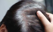 mano che tocca testa con capelli bianchi e neri