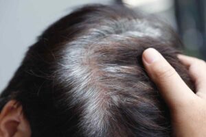 mano che tocca testa con capelli bianchi e neri