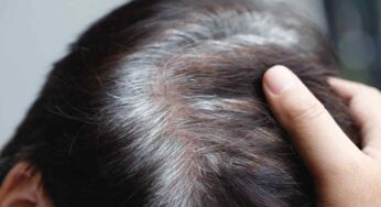 Non ne potevo più dei capelli grigi ma con questo ingrediente economico sono spariti