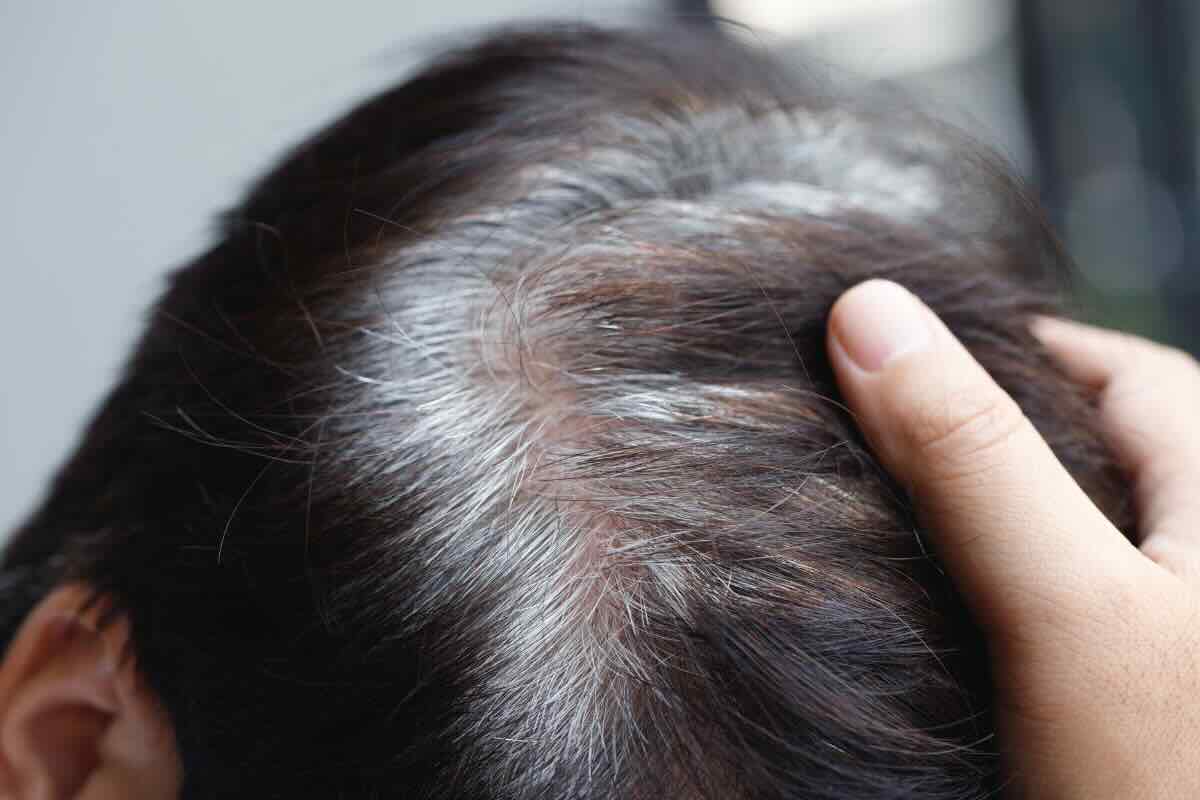 Non ne potevo più dei capelli grigi ma con questo ingrediente economico sono spariti