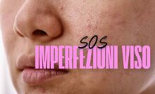 Pelle del viso e scritta 'SOS Imperfezioni viso'