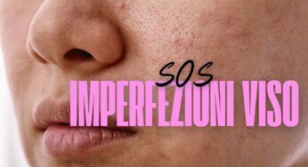 Imperfezioni della pelle: come prevenirle e ridurle con un metodo fai-da-te