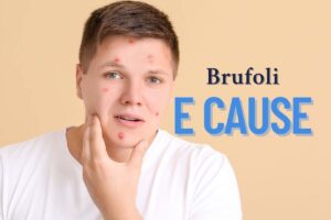 Ragazzo con brufoli e scritta 'brufoli e cause'